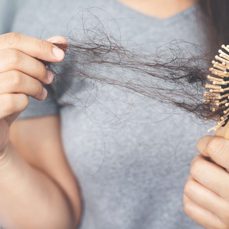 How to Manage Hair Fall Due to PCOS? | Uvi Health
